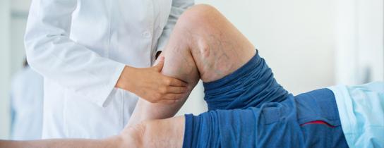 Leg veins being examined by a healthcare provider