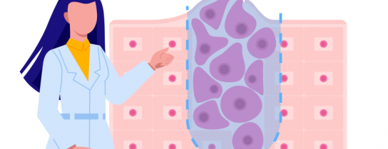 benign-vs-malignant-tumors-feature-image