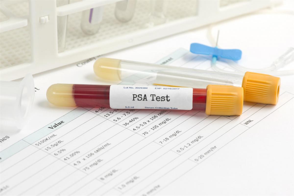 PSA blood test results