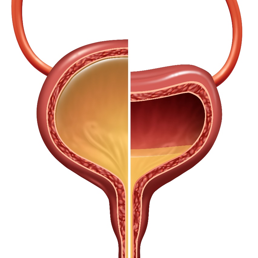 Overactive Bladder (OAB): Symptoms, Diagnosis & Treatment - Urology Care  Foundation