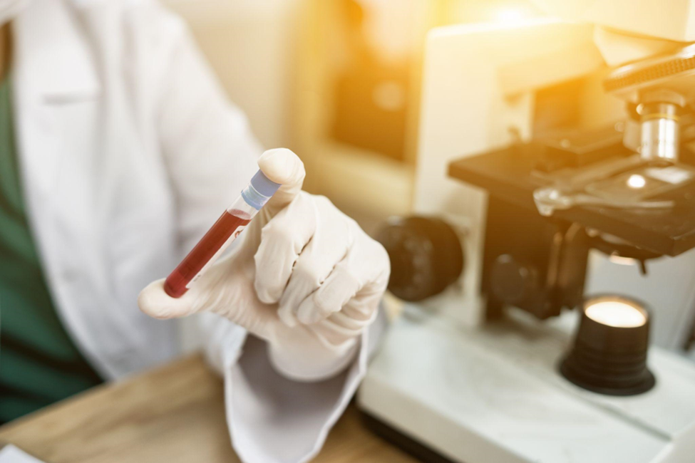 Medical doctor holding blood tube test