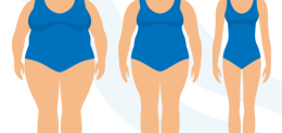 Bariatric-Weight-Loss-Infographic