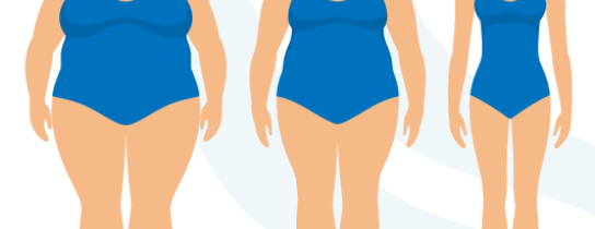 Bariatric-Weight-Loss-Infographic