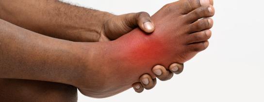 Tarsal Tunnel Syndrome